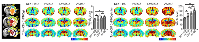Functional Neurovascular Mapping (Director Seong-Gi Kim, Collaborating with Yongho Kim)
