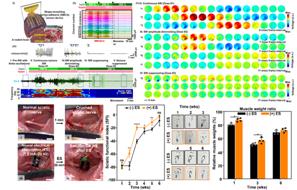 Neural Interfaces (Collaborating with Donghee Son and Mikyung Shin)